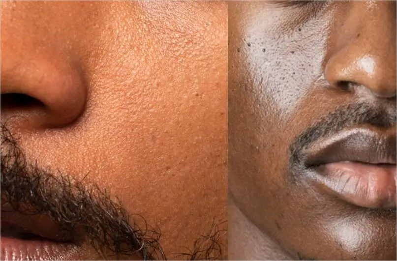 Ways to Identify Your Skin Type with two skin examples