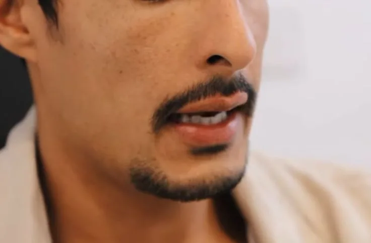 A typical short disconnected goatee 