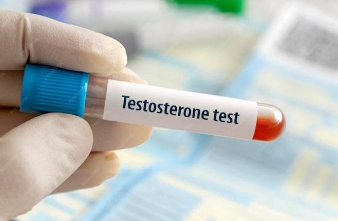 Testosterone Test: How to measure and interpret testosterone levels in men